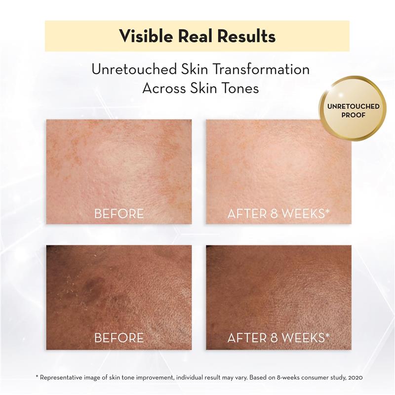 Load image into Gallery viewer, Olay Luminous Niacinamide Honey Peptide Moisturiser 50g

