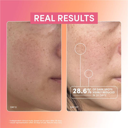 Essano Super Glow Vitamin C 15% Serum 30ml