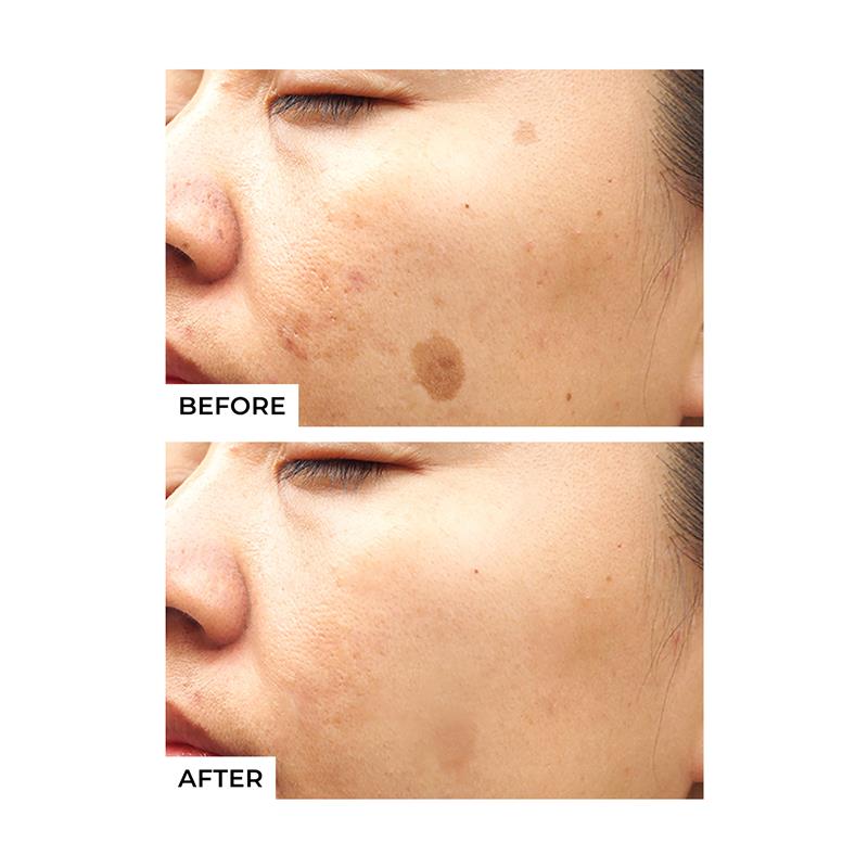Load image into Gallery viewer, Freezeframe Pigment Clear Face Solutions 25ml
