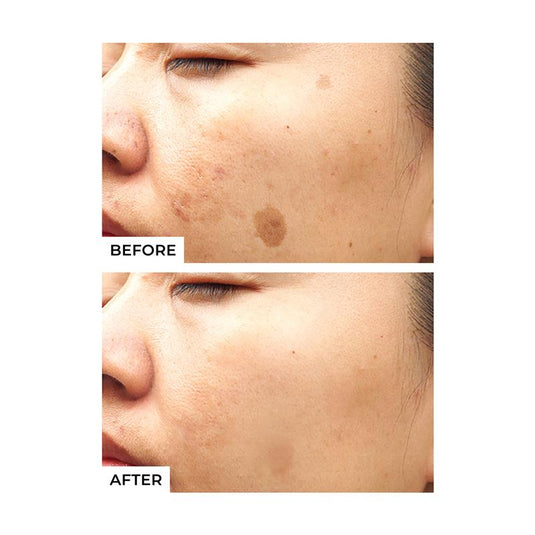Freezeframe Pigment Clear Face Solutions 25ml