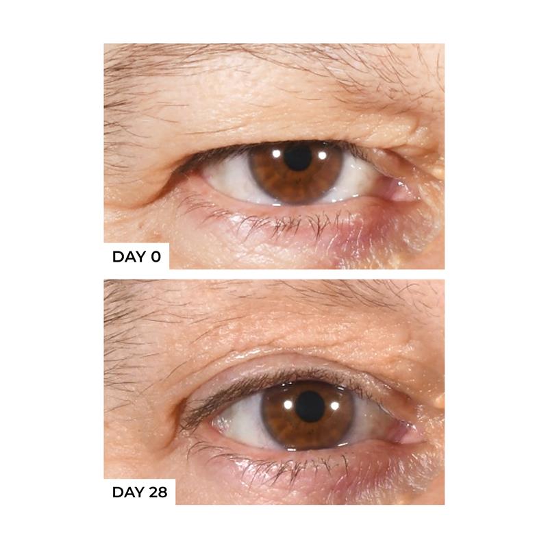 Load image into Gallery viewer, Freezeframe Eyelid Lift 15ml
