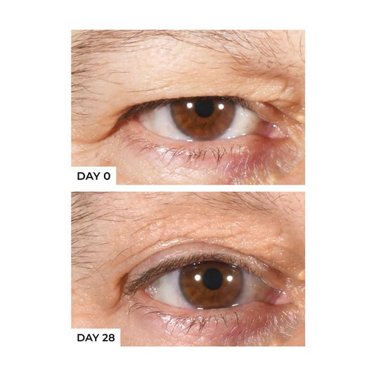 Freezeframe Eyelid Lift 15ml