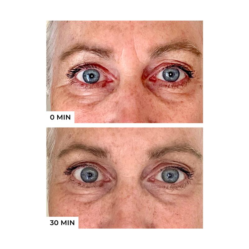 Load image into Gallery viewer, freezeframe 48 Hour Wrinkle Freeze Mask
