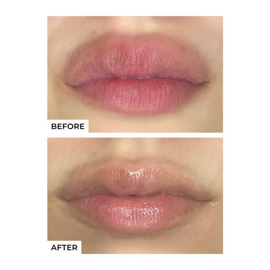 freezeframe LIP INJECTION 10ml