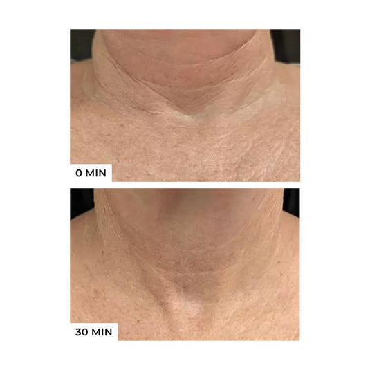 Freezeframe Neck Lift 50ml
