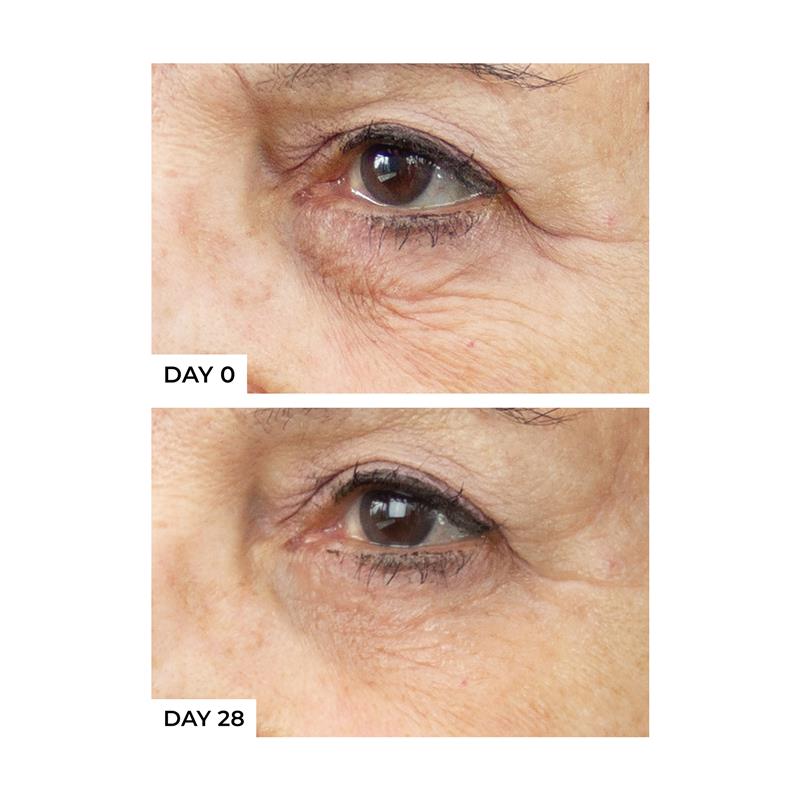 Load image into Gallery viewer, freezeframe REVITALEYES 15ml
