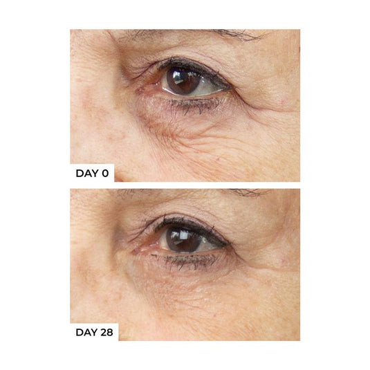 freezeframe REVITALEYES 15ml