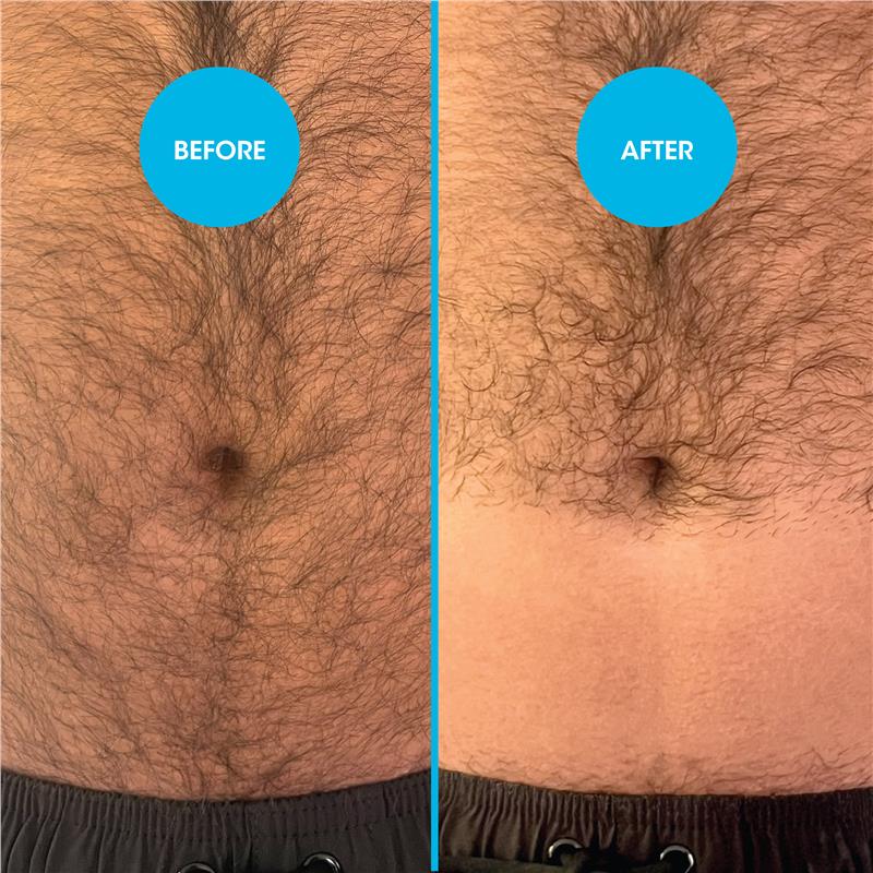 Load image into Gallery viewer, Nad's for Men Down Under Hair Removal Cream 150ml
