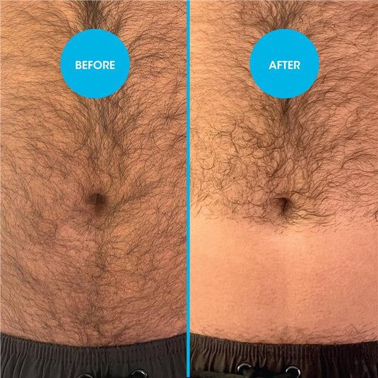 Nad's for Men Down Under Hair Removal Cream 150ml
