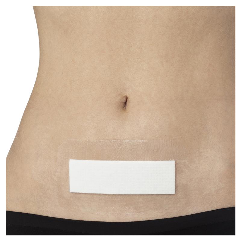 Load image into Gallery viewer, Opsite Post-Op 15cm X 8cm Single Dressing
