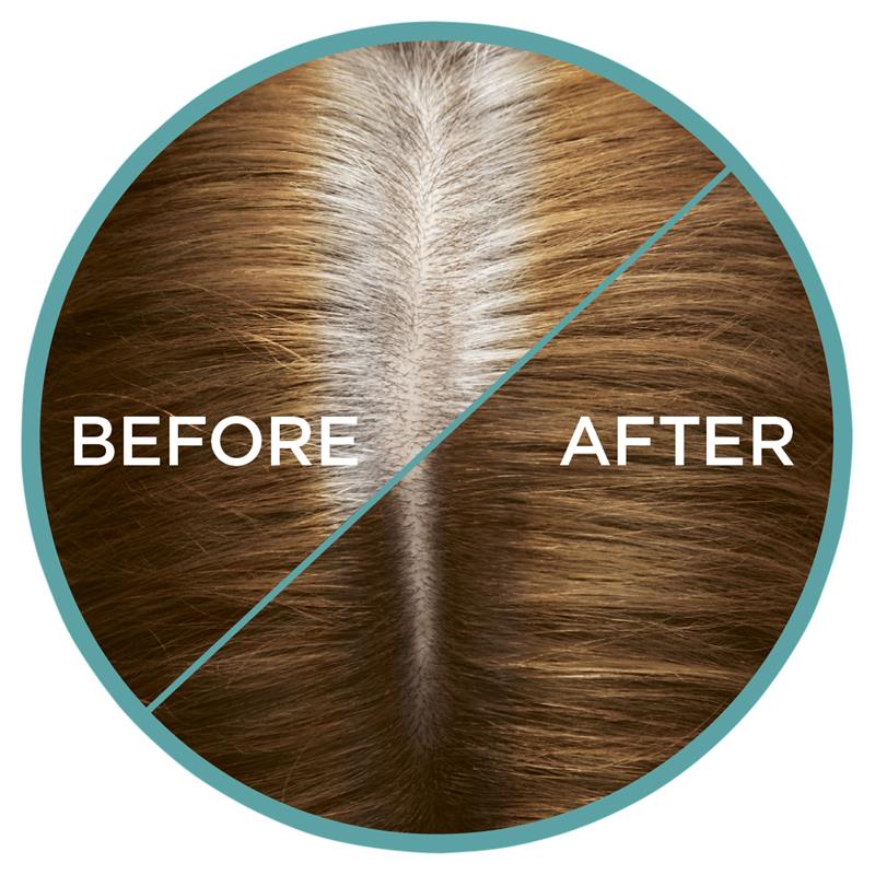 Load image into Gallery viewer, L'Oreal Paris Magic Retouch Temporary Root Concealer Spray - Golden Brown (Instant Grey Hair Coverage)
