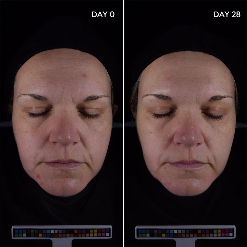 Load image into Gallery viewer, Bioderma Sebium Anti Imperfection Smoothing Concentrate Serum for Acne Prone Skin 30ml
