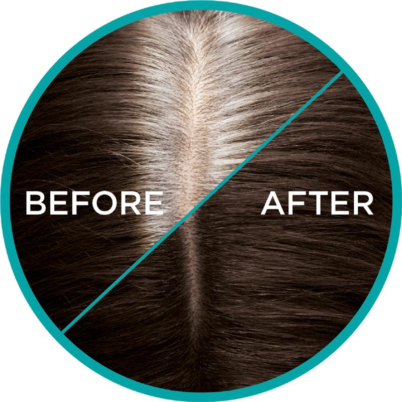 Load image into Gallery viewer, L'Oreal Paris Magic Retouch Temporary Root Concealer Spray - Dark Brown(Instant Grey Hair Coverage)
