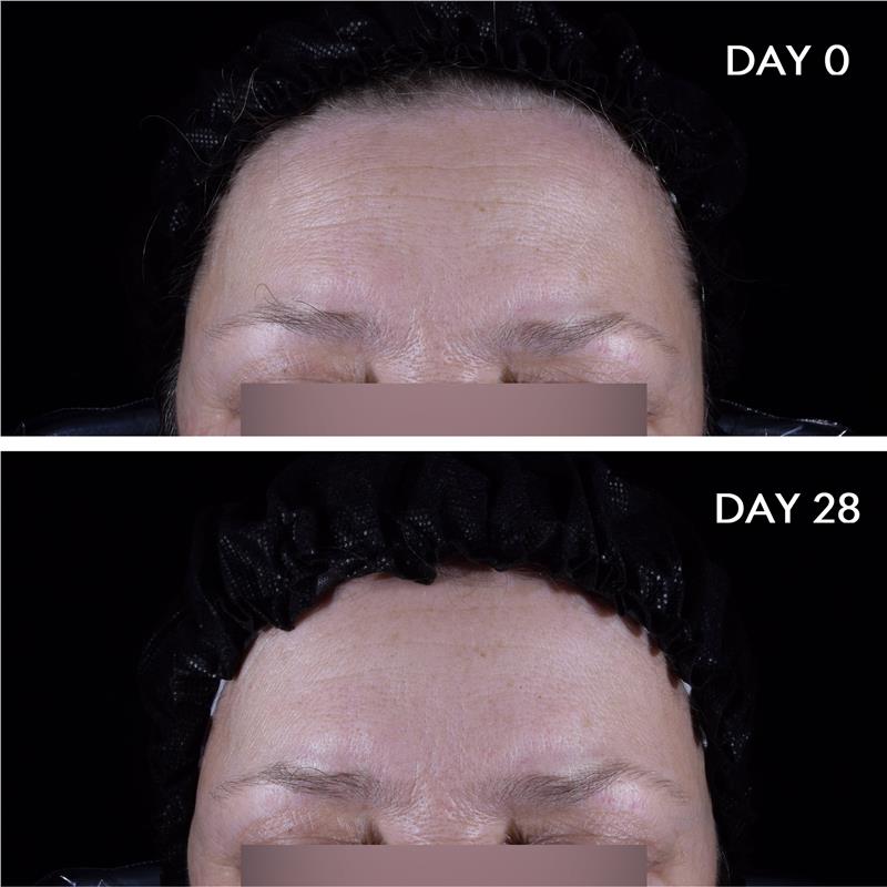 Load image into Gallery viewer, Bioderma Hydrabio Hyalu + Hydrating Plumping Serum with Hyaluronic Acid and Niacinamide 30ml
