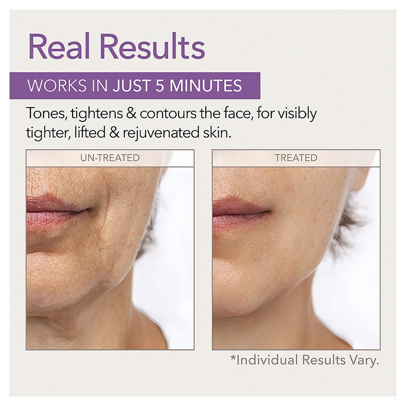 Load image into Gallery viewer, Skin Doctors Instant Facelift 30ml

