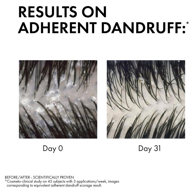 Load image into Gallery viewer, Dercos Anti-Dandruff Shampoo for Sensitive Scalp 200ml

