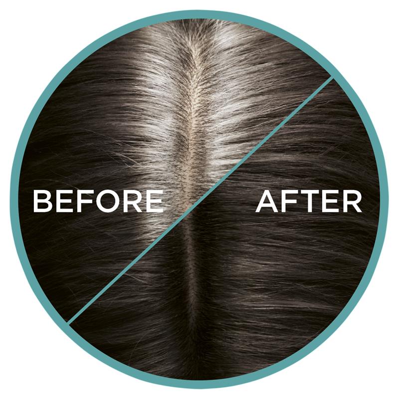 Load image into Gallery viewer, L'Oreal Paris Magic Retouch Temporary Root Concealer Spray - Cool Dark Brown (Instant Grey Hair Coverage)
