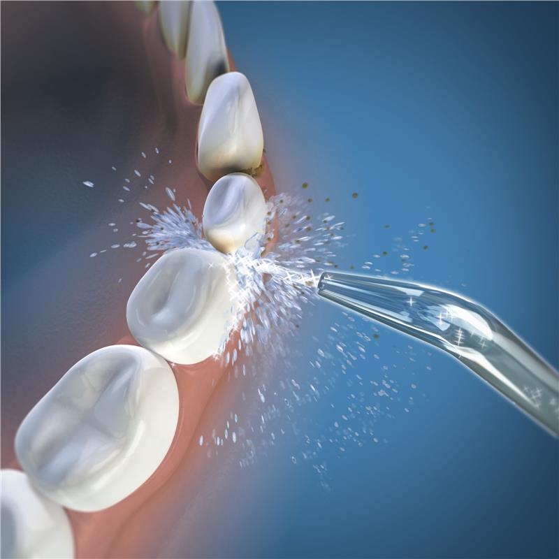 Load image into Gallery viewer, Waterpik Classic Jet Tips 2 Pack
