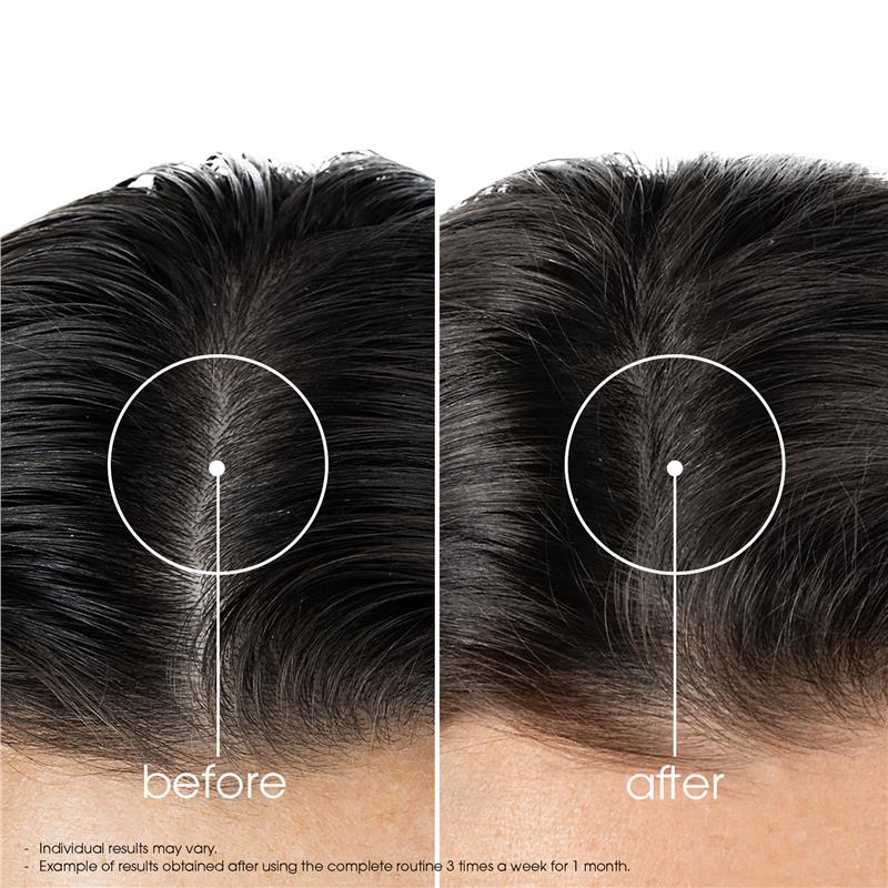 Load image into Gallery viewer, Klorane Strengthening Quinine &amp; Organic Edelweiss Conditioner 200ml
