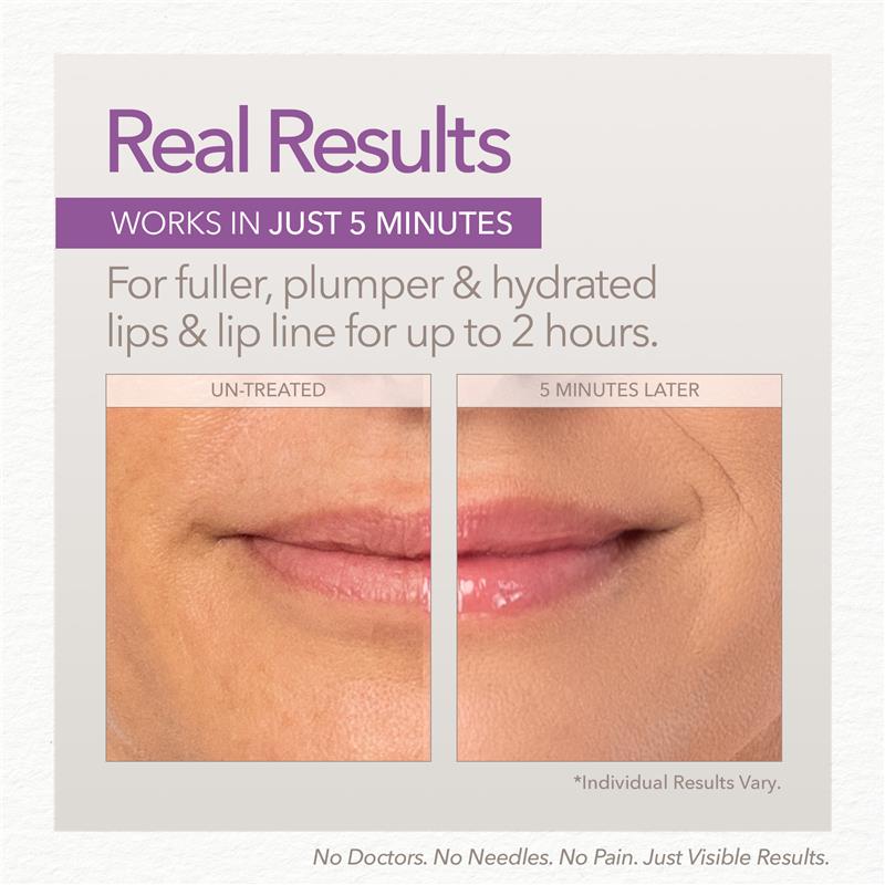 Load image into Gallery viewer, Skin Doctors Instant Lip Plumper 3ml
