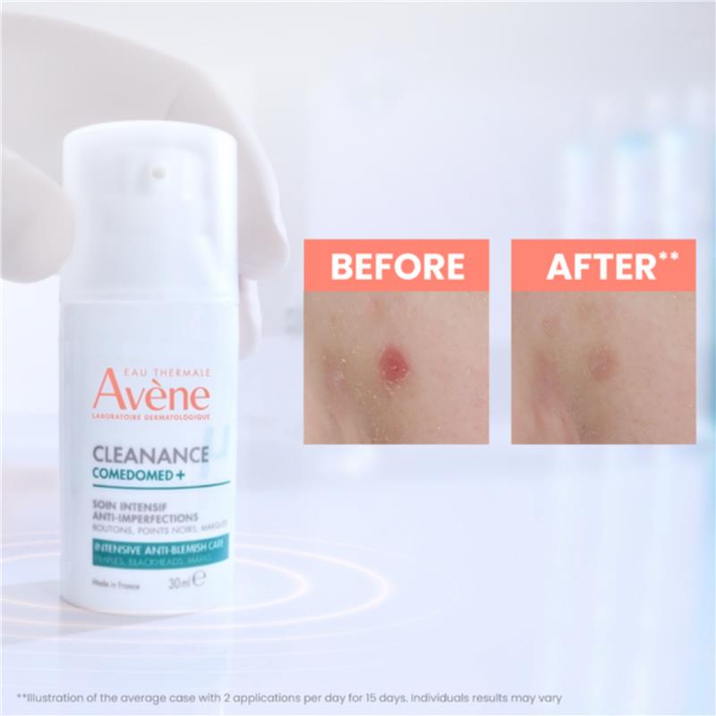 Load image into Gallery viewer, Avene Cleanance Starter Kit - For Oily skin
