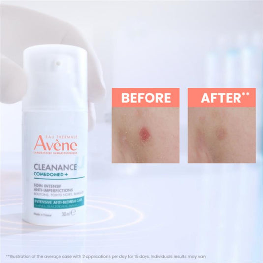 Avene Cleanance Starter Kit - For Oily skin