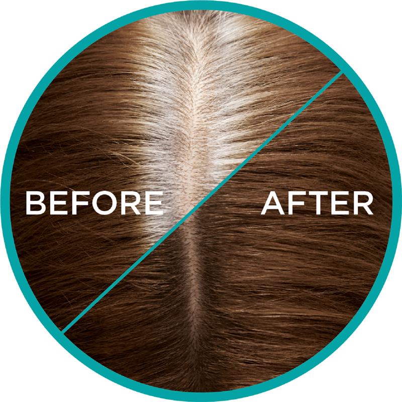 Load image into Gallery viewer, L'Oreal Paris Magic Retouch Temporary Root Concealer Spray - Brown(Instant Grey Hair Coverage)
