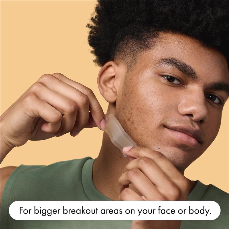 Load image into Gallery viewer, Hero Mighty Patch Surface Pimple Patches 10 pack
