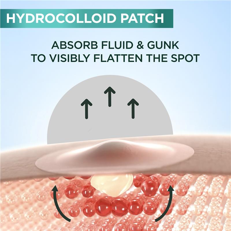 Load image into Gallery viewer, Garnier Pure Active Pimple Patch 44pk
