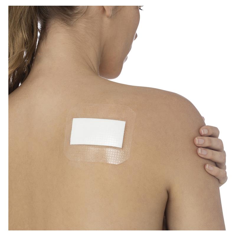 Load image into Gallery viewer, OPSITE POST-OP 9.5cmX8.5cm PK3
