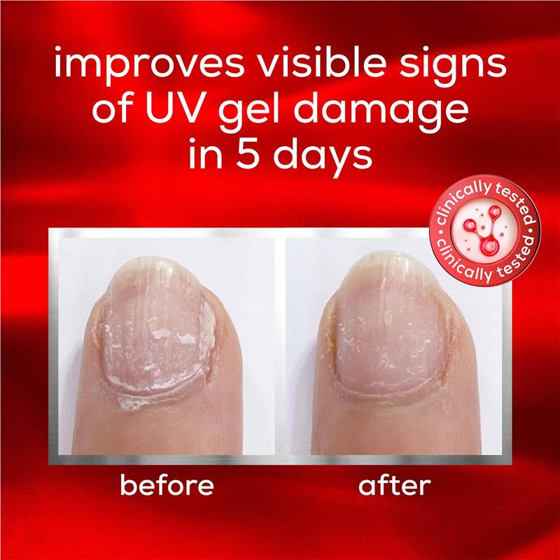 Load image into Gallery viewer, Essie To The Rescue Advanced Nail Treatment
