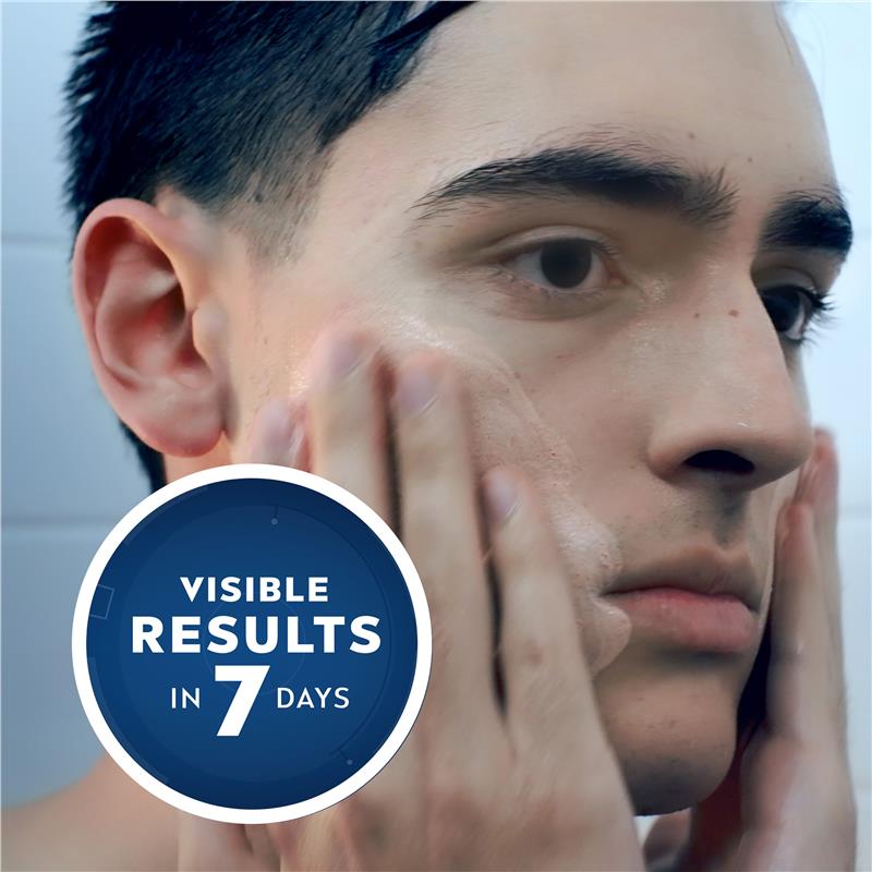 Load image into Gallery viewer, NIVEA MEN Face Wash Deep Rapid Acne Clear 150ml
