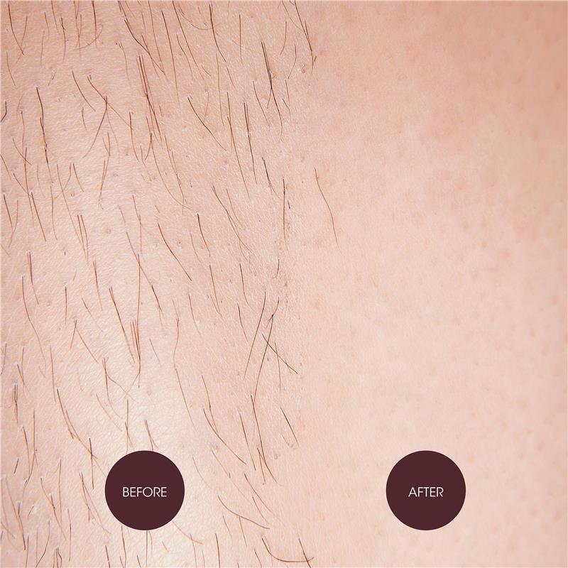 Load image into Gallery viewer, Nad's Sensitive Hair Removal Cream 150ml
