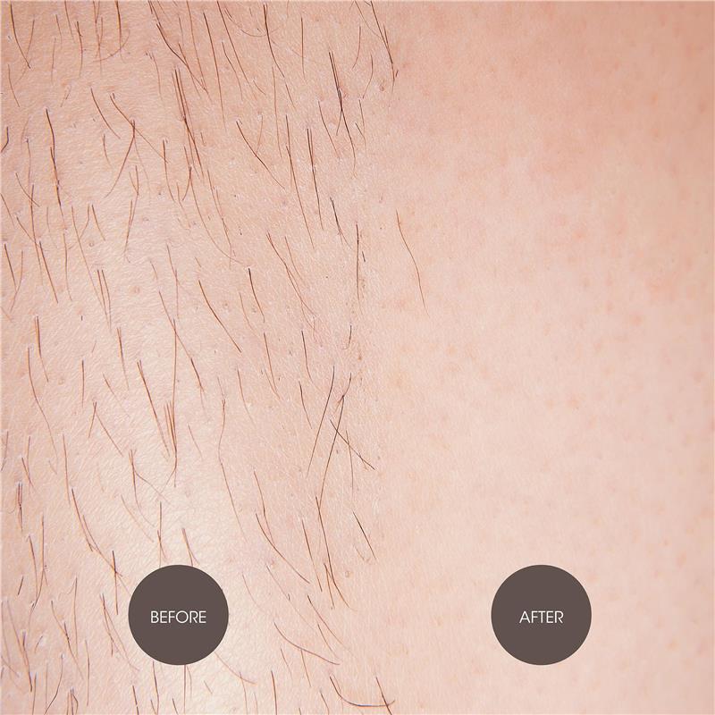 Load image into Gallery viewer, Nad's Natural Sugar Wax 370g
