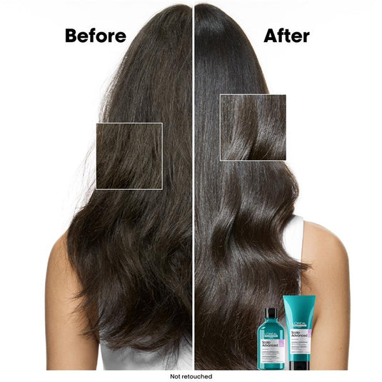 L'Oreal Professionnel Serie Expert Scalp Advanced Anti Discomfort Treatment 200ml