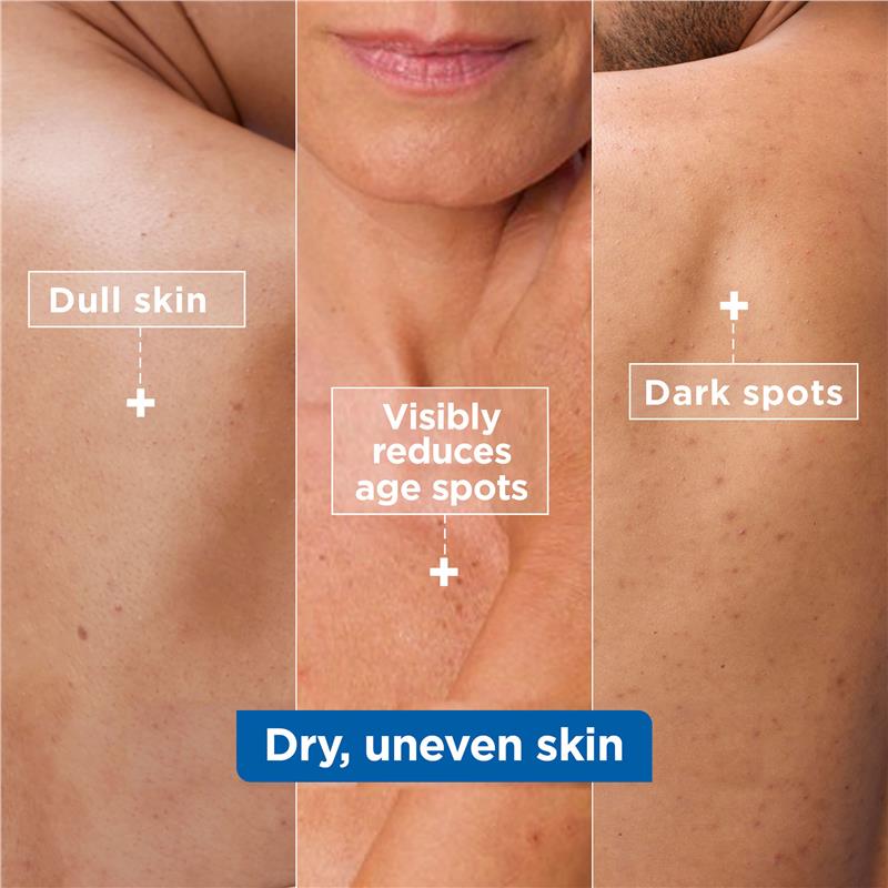Load image into Gallery viewer, Mixa Niacinamide Bright Moisturising Anti-Dark Spot Cream 400ml
