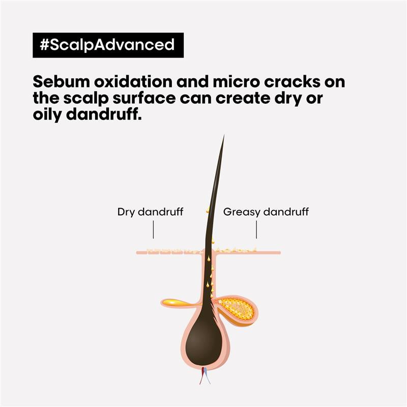 Load image into Gallery viewer, L'Oreal Professionnel Serie Expert Scalp Advanced Anti Dandruff Shampoo 300ml
