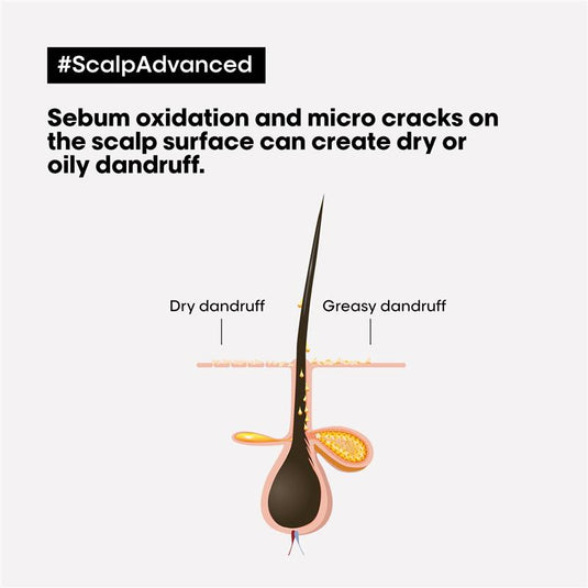 L'Oreal Professionnel Serie Expert Scalp Advanced Anti Dandruff Shampoo 300ml