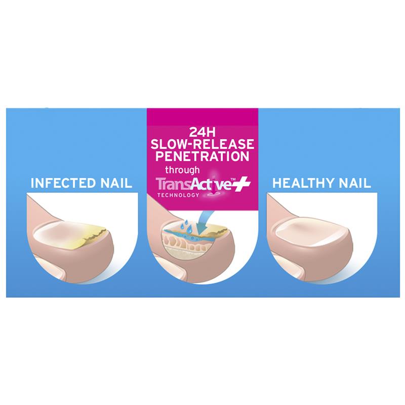 Load image into Gallery viewer, Excilor Ultra Fungal Nail Treatment 30ml
