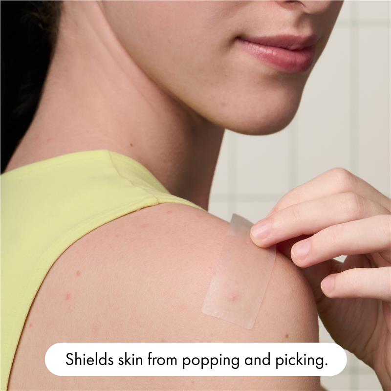 Load image into Gallery viewer, Hero Mighty Patch Surface Pimple Patches 10 pack
