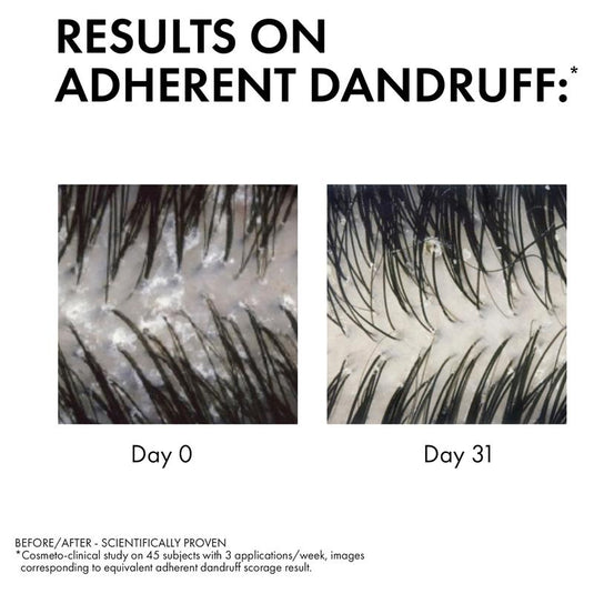 Dercos Anti-Dandruff DS Shampoo for Dry Hair 200ml