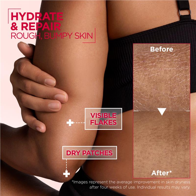 Load image into Gallery viewer, Mixa Urea Cica Repair+ Renewing Cream 400ml
