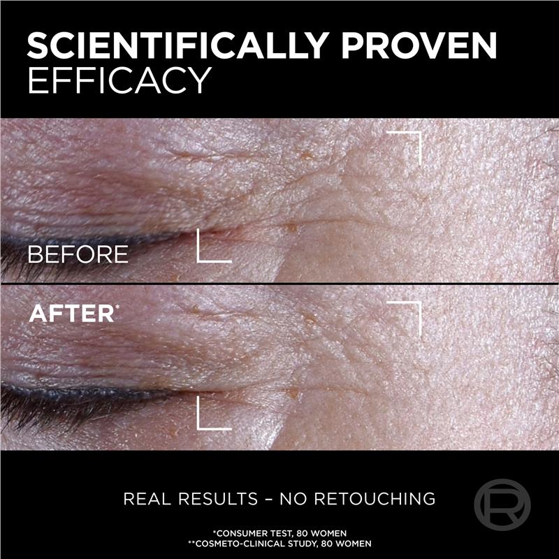 Load image into Gallery viewer, L'Oreal Paris Age Perfect Midnight Eye Cream
