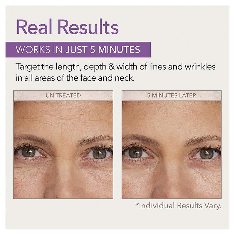 Load image into Gallery viewer, Skin Doctors Instant Wrinkle Filler 10ml
