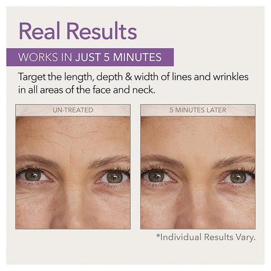 Skin Doctors Instant Wrinkle Filler 10ml