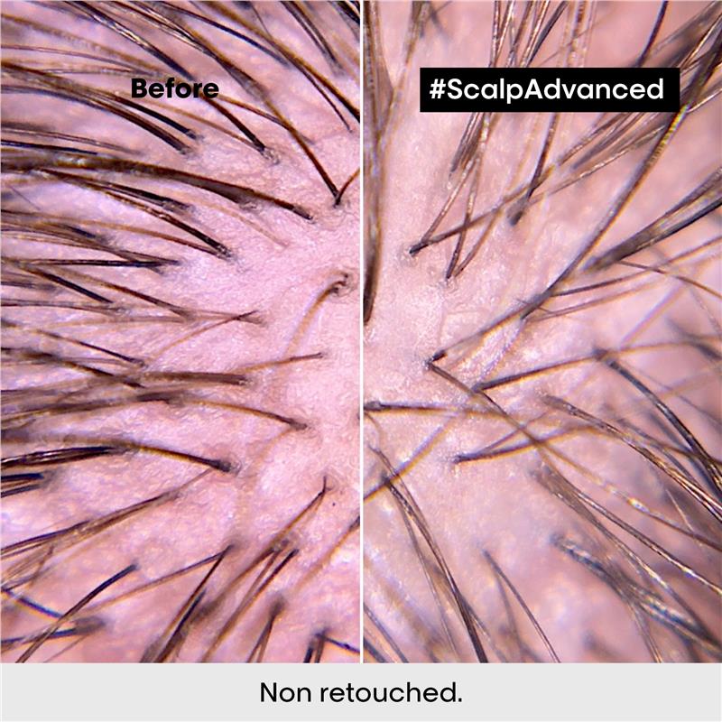 Load image into Gallery viewer, L'Oreal Professionnel Serie Expert Scalp Advanced Anti Discomfort Treatment 200ml
