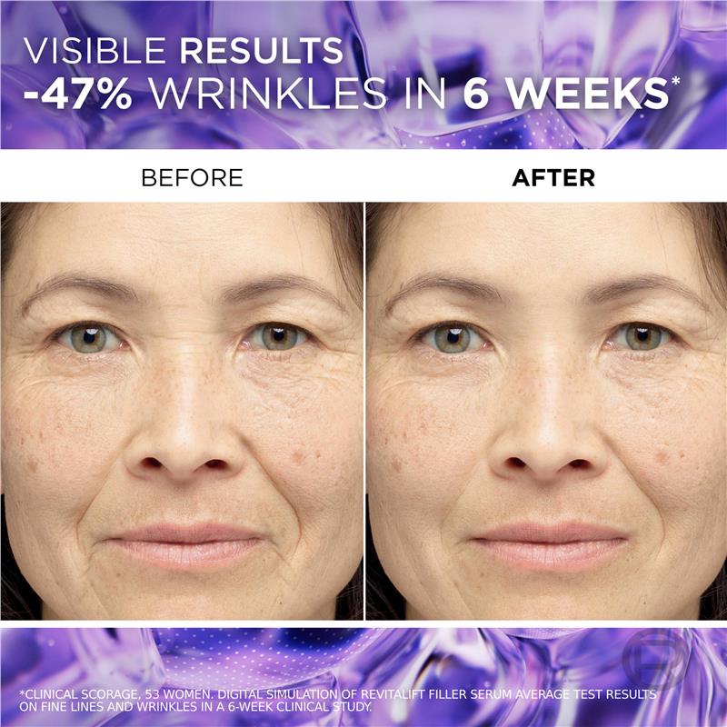 Load image into Gallery viewer, L'Oreal Paris Revitalift Filler Hyaluronic Acid Anti Wrinkle Serum 30ml
