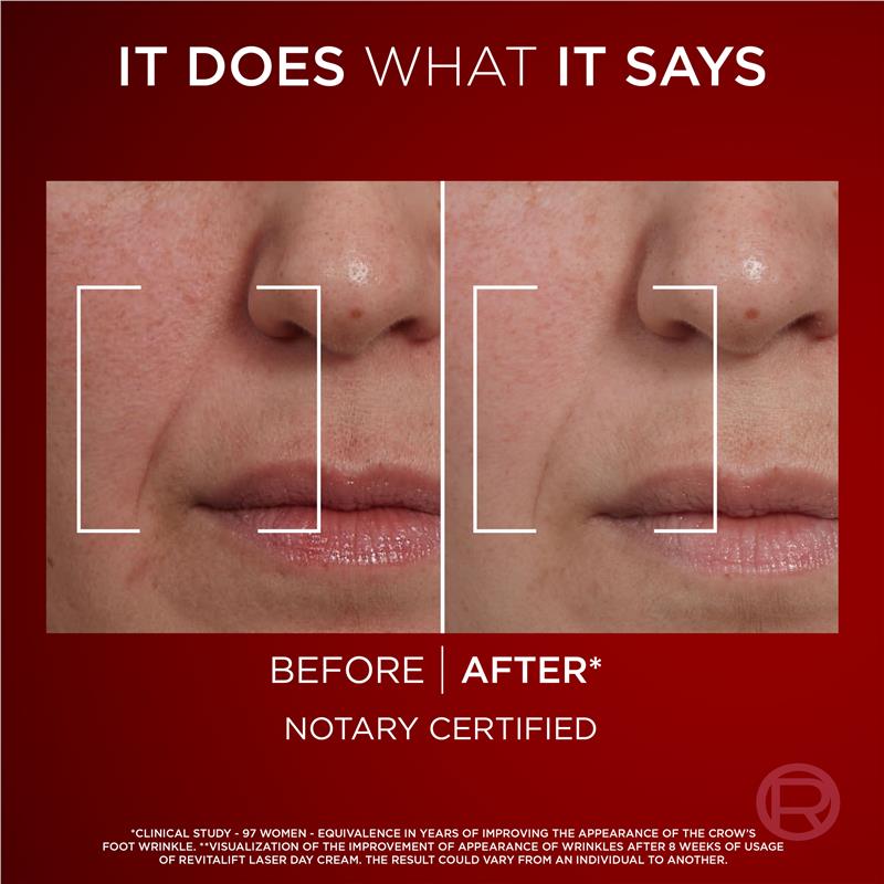 Load image into Gallery viewer, L'Oreal Paris Revitalift Laser X3 Day Cream SPF 15 50ml
