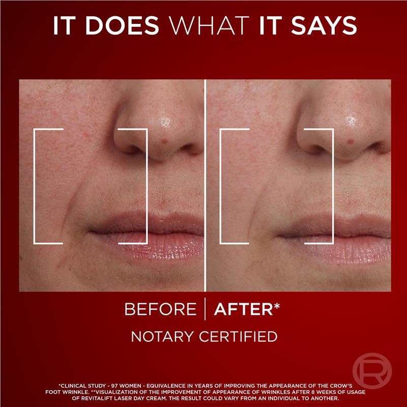 Load image into Gallery viewer, L'Oreal Paris Revitalift Laser X3 Day Cream 50ml
