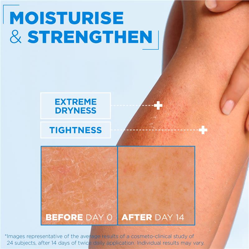 Load image into Gallery viewer, Mixa Ceramide Protect Strengthening Cream 400ml
